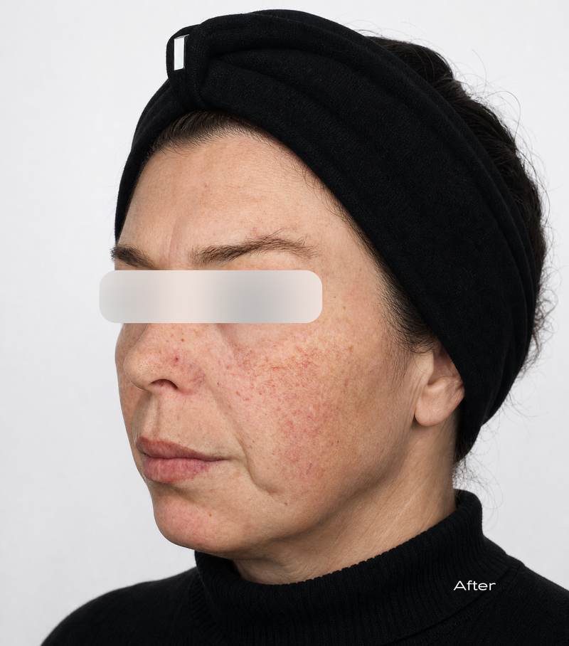After